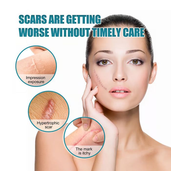 Dermacure™ Silicone Scar Tape