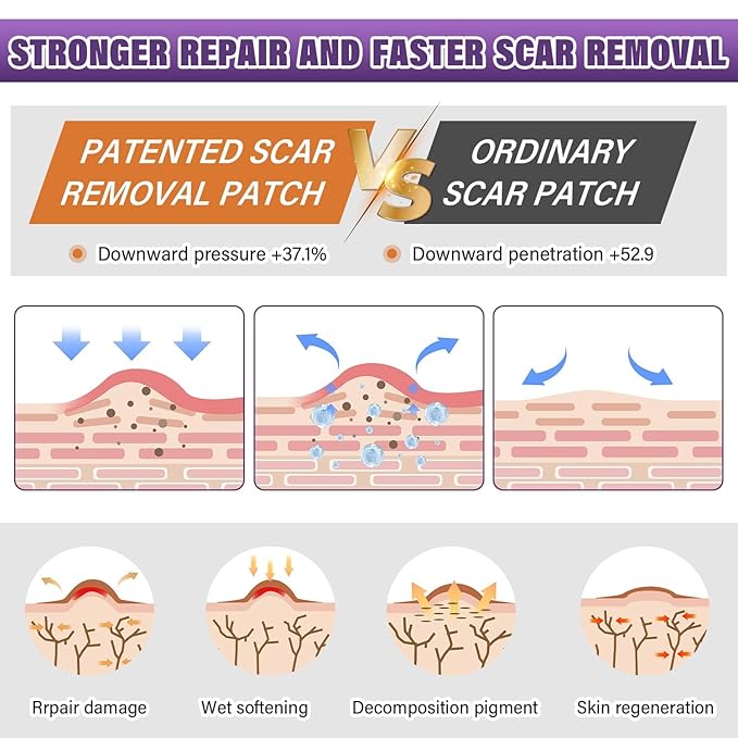 Dermacure™ Silicone Scar Tape