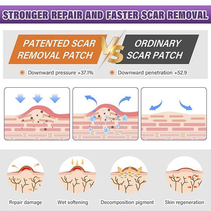 Dermacure™ Silicone Scar Tape