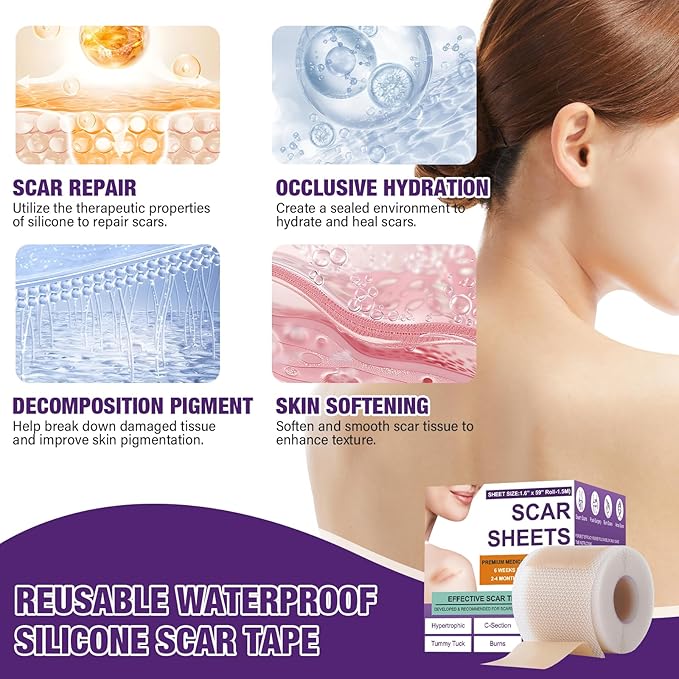 Dermacure™ Silicone Scar Tape