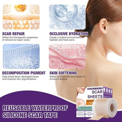 Dermacure™ Silicone Scar Tape