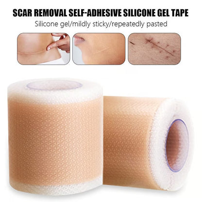 Dermacure™ Silicone Scar Tape