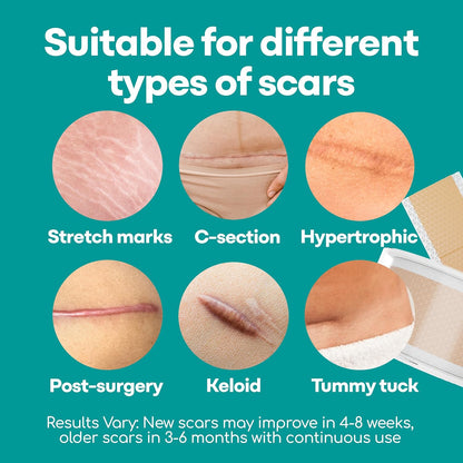 Dermacure™ Silicone Scar Tape