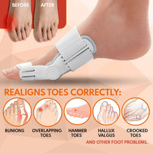 AlignEase™ 3D Bunion Splint Corrector Device