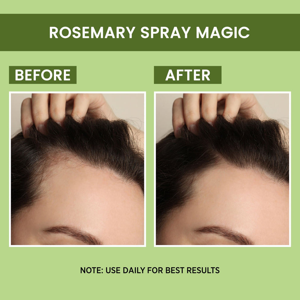 Alps Natural™ Rosemary Water, Hair Spray For Regrowth (Pack of 2)